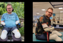 Nieuw leven voor Kees en zijn jonge gezin na amputatie van zijn ledematen