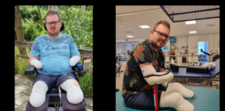 Nieuw leven voor Kees en zijn jonge gezin na amputatie van zijn ledematen