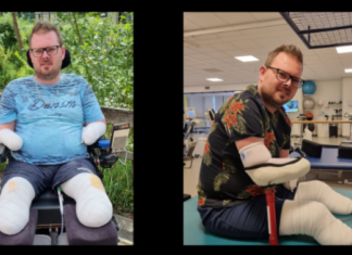 Nieuw leven voor Kees en zijn jonge gezin na amputatie van zijn ledematen